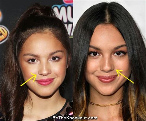 did olivia rodrigo get breast implants|Sneaky plastic surgeries used by celebs to look better than you